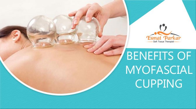 BENEFITS OF MYOFASCIAL CUPPING